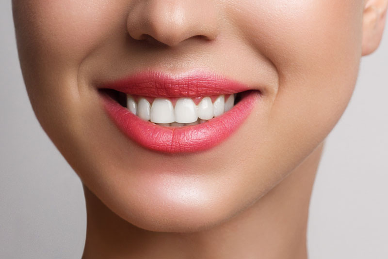 snap on smiles patient